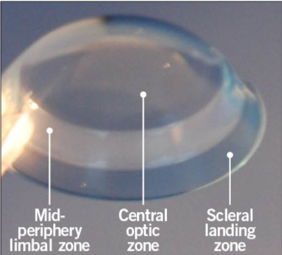 2. Lens-thumb-400xauto-1623